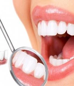 BỌC RĂNG SỨ Ở ĐÂU TỐT