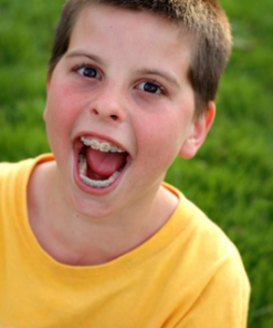 CÓ NÊN NIỀNG RĂNG CHO TRẺ