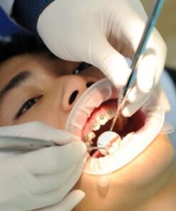 CÓ NÊN NIỀNG RĂNG CHO TRẺ