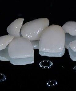 DÁN RĂNG SỨ VENEER