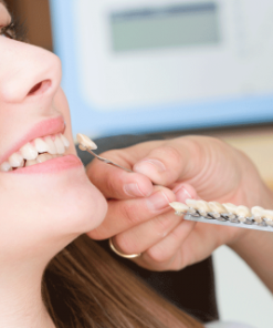 DÁN RĂNG SỨ VENEER