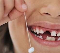 GIAI ĐOẠN THAY RĂNG CỦA TRẺ