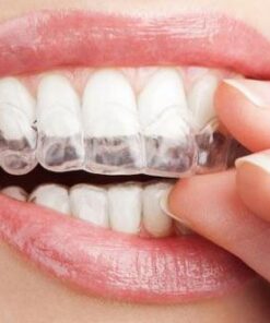 GIÁ CẢ NIỀNG RĂNG 1 HÀM