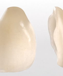 GIÁ MẶT DÁN SỨ VENEER