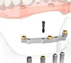 HÀM PHỦ TRÊN IMPLANT