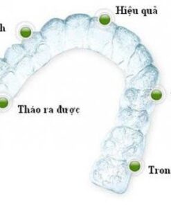 NIỀNG RĂNG TRONG SUỐT GIÁ BAO NHIÊU
