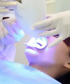 TẨY TRẮNG RĂNG Ở ĐÂU TỐT NHẤT